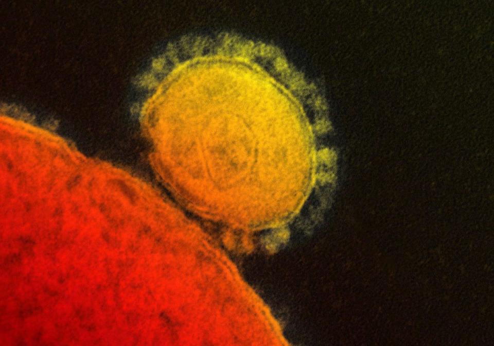 US confirms its first case of MERS virus (as if we don't have enough problems) D6484c4431ff0a11530f6a7067005153