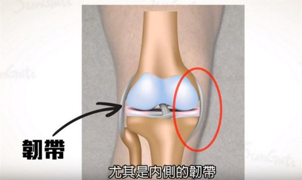 內側韌帶受傷的患者，常會發現自己的膝蓋內側莫名疼痛，尤其在走路或是下蹲時特別明顯。（圖片／擷取自Sunguts youtube影片）