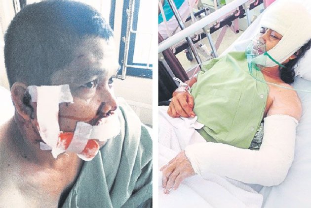 Hoosni (left) and Ruhimah in hospital after being attacked by two bulldogs. ― Malay Mail pic