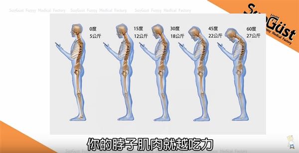 當你的頭越往前、往下彎使用手機，你的脖子肌肉就越吃力。（圖片／擷取自Sunguts youtube影片）