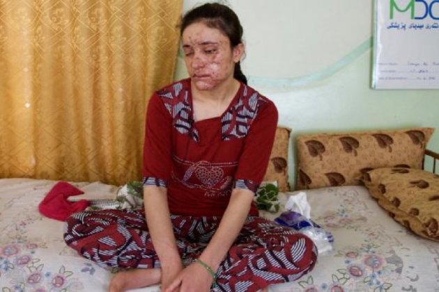 今年才18歲的巴夏爾（Lamiya Aji Bashar），是名亞茲迪（Yazidi）教徒，在ISIS追捕中不慎誤觸地雷，奪走她的右眼，也在她臉上留下傷疤。（AP）