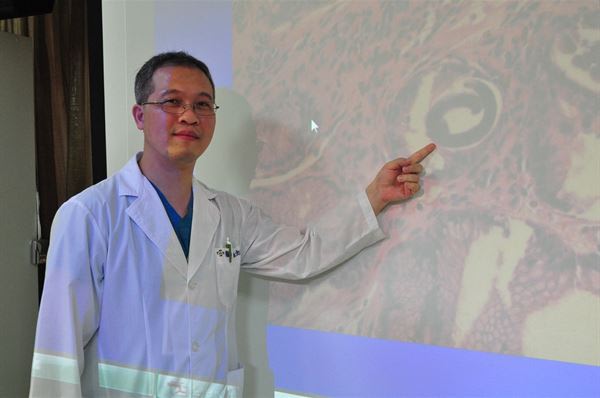 陳忠宏醫師表示，「糞小桿線蟲」主要是經由糞口傳染，感染者的臨床表徵不明顯，但嚴重可能會危及生命。（圖片提供／彰濱秀傳醫院）