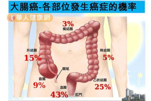 大腸癌個好發部位不同，其中又以肛門直腸比例居多。（圖片提供／亞東醫院）